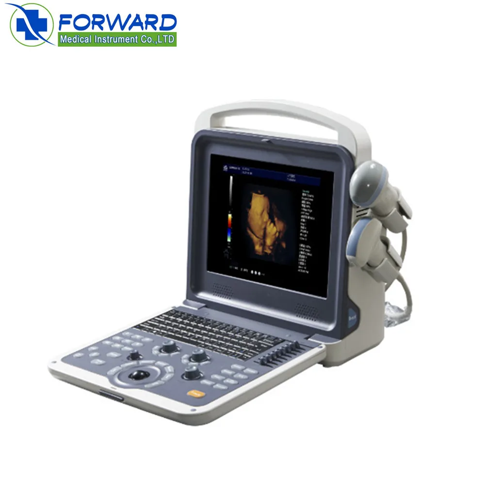 3D&4D ultrasound scan imaging function /china portable ultrasound machine price