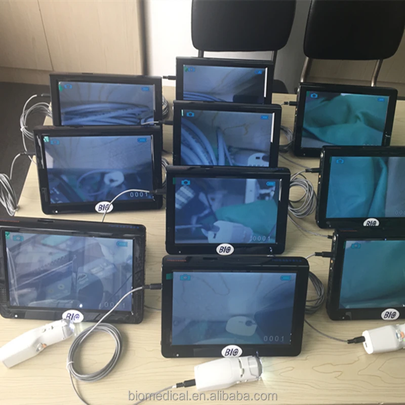 Mini Colposcopy USB Colposcopes For Sale Video Bolposcope Price
