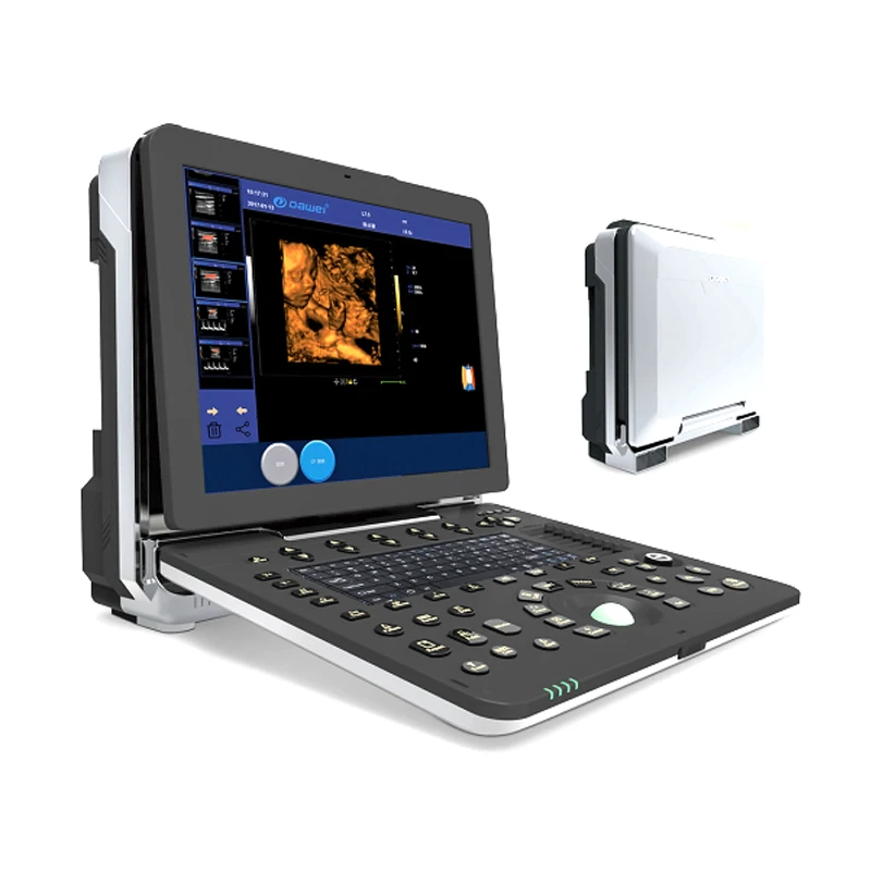portable ultrasound price, 2d/3d/4d ultrasound