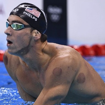 
massage grade back cupping/magic hijama therapy gifts/TCM perfect device 