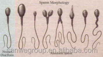 SW-3702  Portable Laptop Semen Analyzer