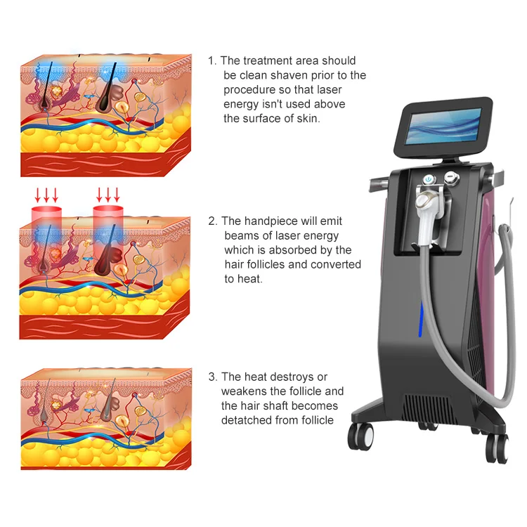 
OSANO professional 808nm painless hair removal machine laser 808 diode 