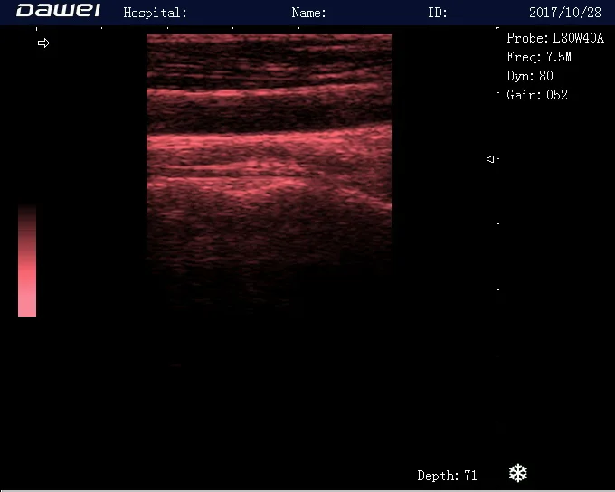 DW-580 портативная, полностью цифровая, ультразвуковая диагностическая система 2d ultrasound portable machine