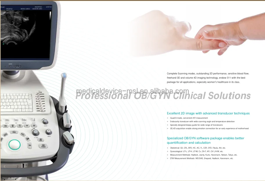 Ультразвуковой цветной допплер-сканер Sonoscape S11 с высоким разрешением echo