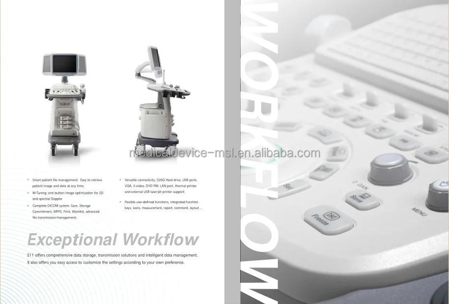 Ультразвуковой цветной допплер-сканер Sonoscape S11 с высоким разрешением echo