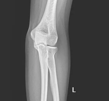 Пленки Agfa agfa drystar фильм dt2b agfa dt2b фильм, fuji drypix lite сухой пленки