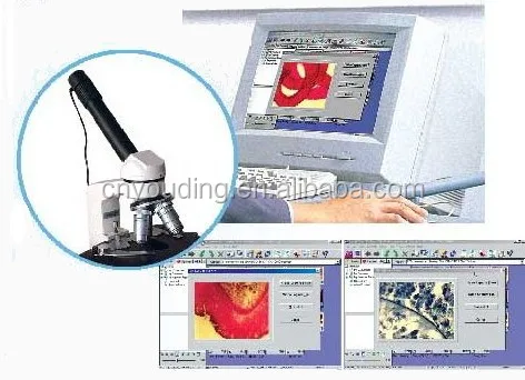 High quality digital microscope camera