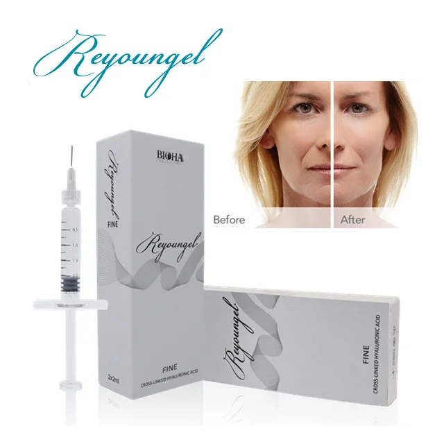 
Reyoungel Cross Linked Hyaluronic Acid Buy Injectable Dermal Fillers 