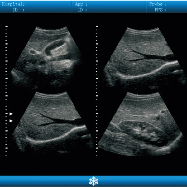 Maquina Ultrasonic Portatil De Alta Calidad Para Humanos Y Animales