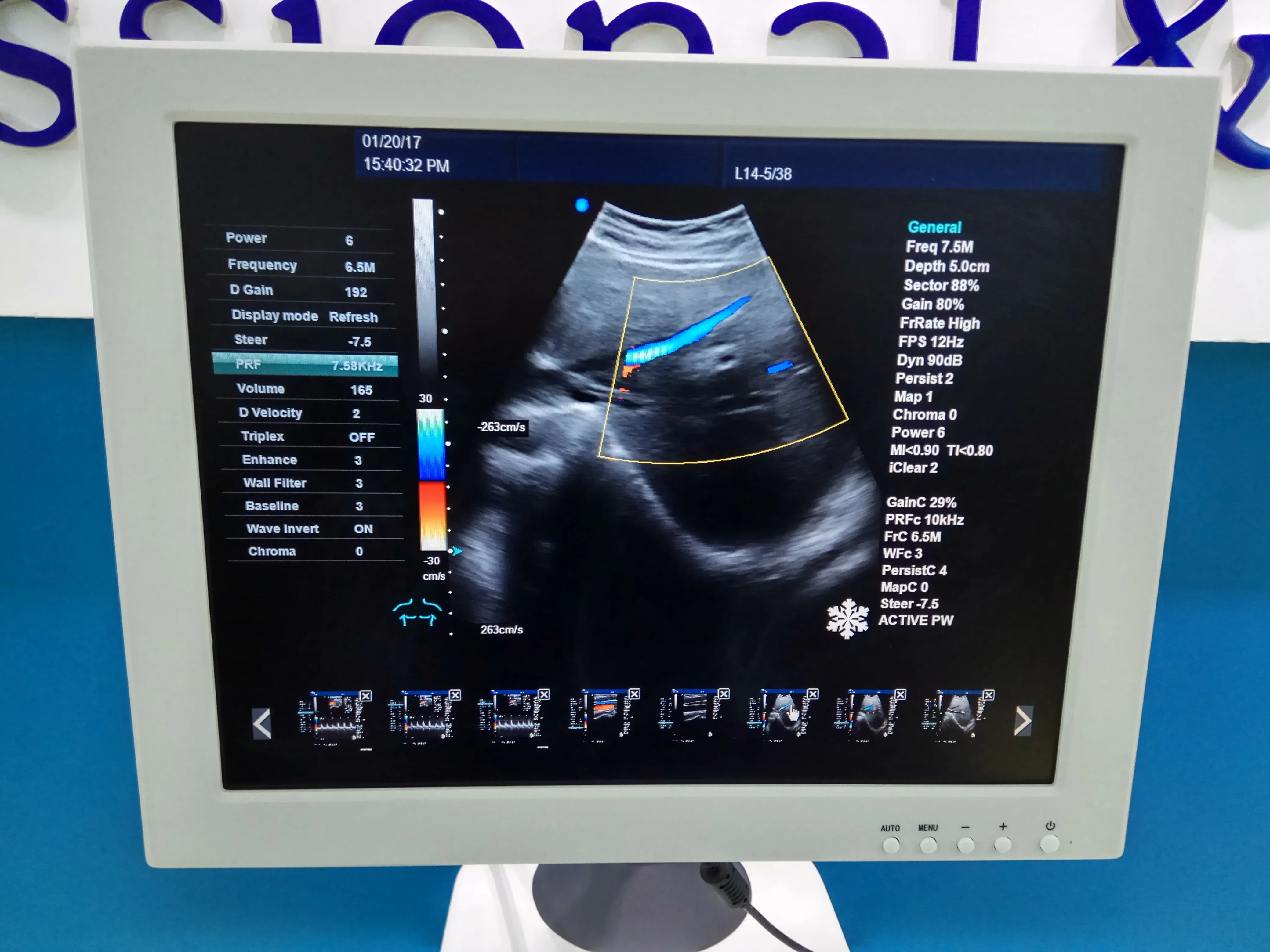 Ультразвуковая диагностическая система Доплера 3D 4D