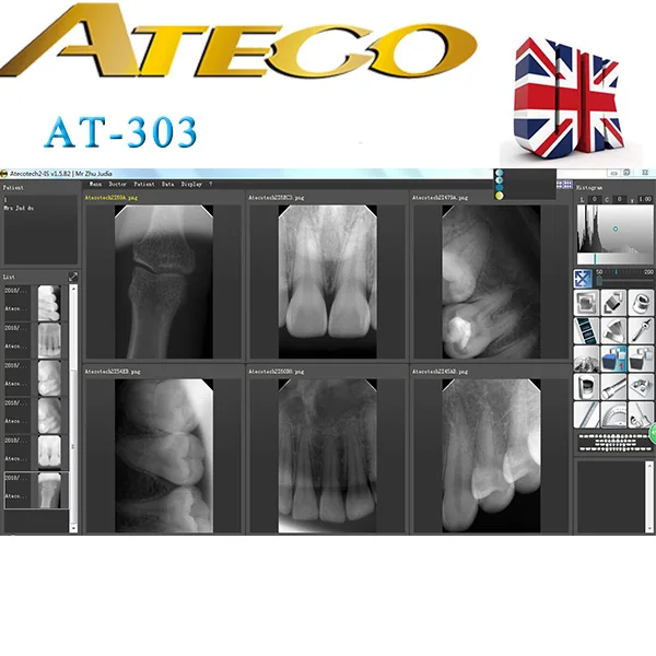 ATECO  digital  x  ray  sensor  dental  rvg  made  in  UK