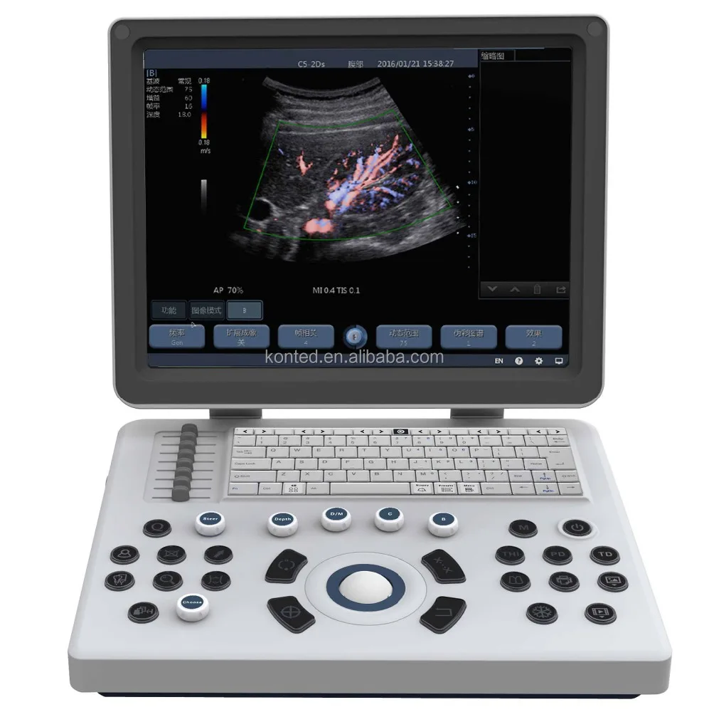 China Doppler Ultrasound Manufacturers Ultrasound Machine Portable Vascular Doppler