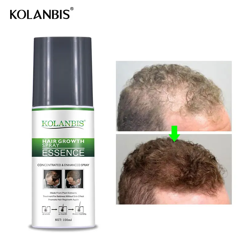 Effective Hair Regrowth Tonic Bald Head Treatment With Organic Herbal Plants Extracts