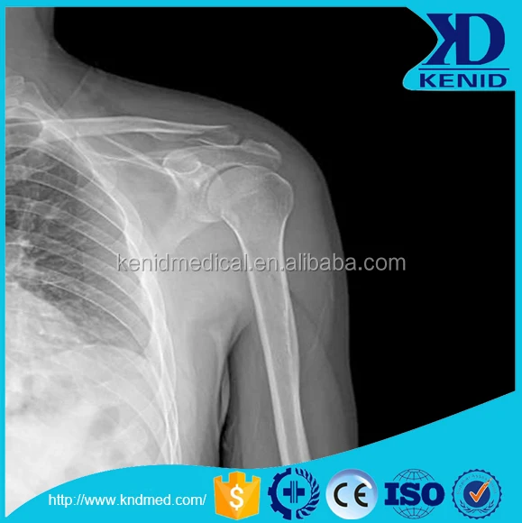  x ray equipment sale compatible fuji & agfa cr KND-A/F xray film 8x10inch