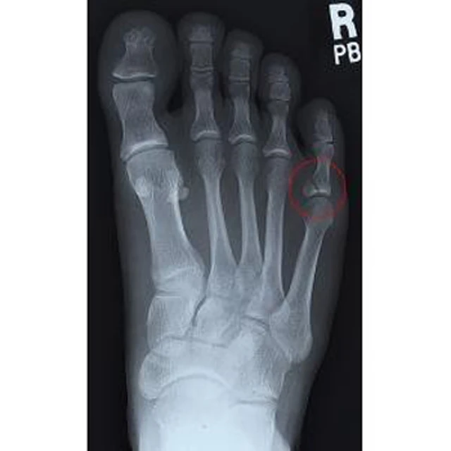 fuji di-hl dry laser imaging film 8 x 10 (20 x 25cm)