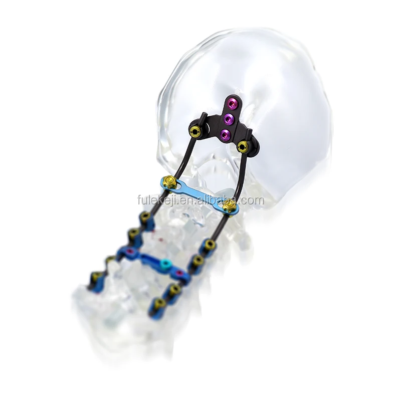 
Thoracic-lumbar spinal fusion cage titanium orthopedic implants 