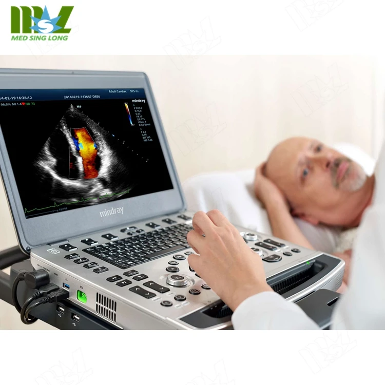 High quality Mindray color doppler portable ultrasound machine laptop ultrasound mindray m9 for human medical