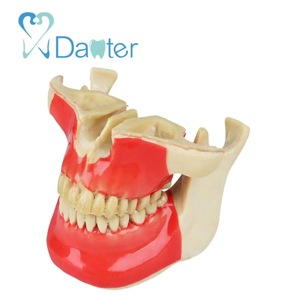 Good Quality Ortho Implant Practice Jaw Model Dental Implant Model
