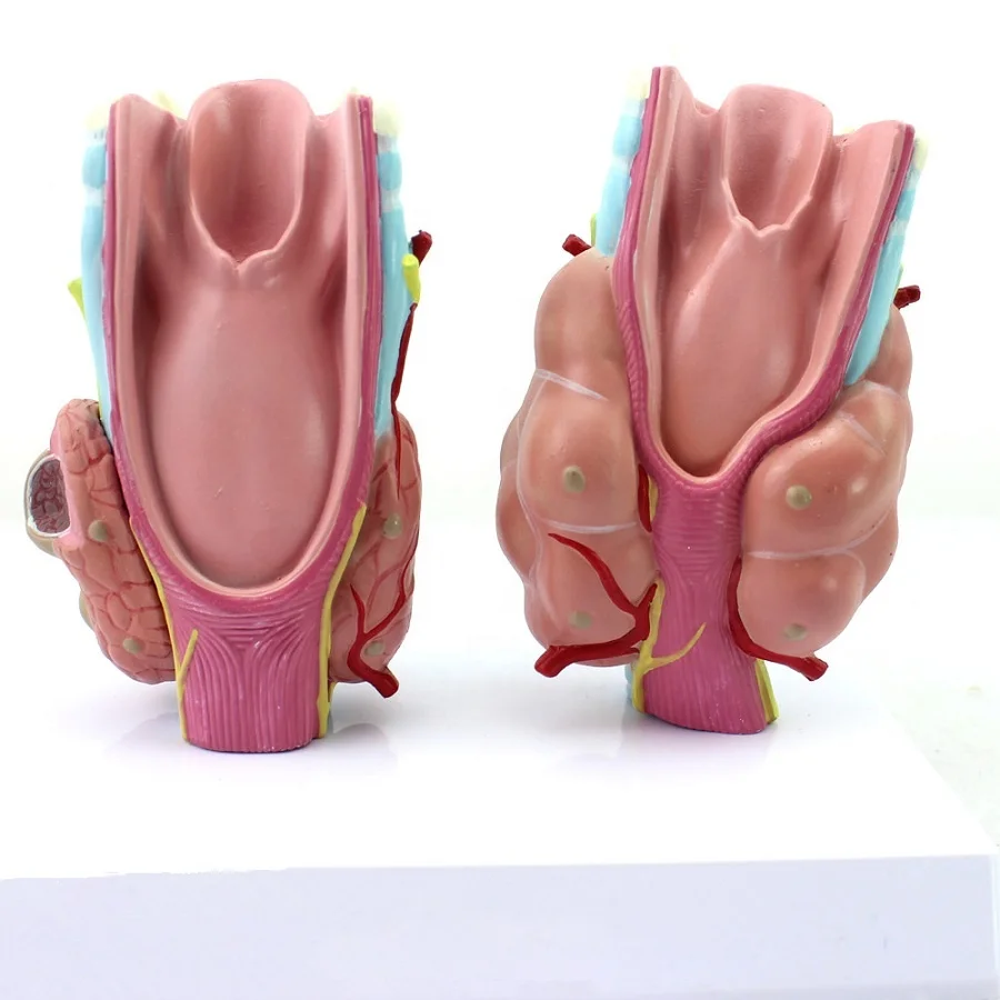 Human thyroid pathology model