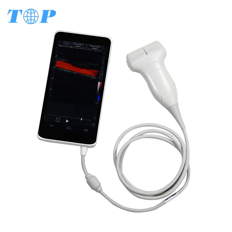TOP-A1025 portable 4d color doppler ultrasound scanner system usb