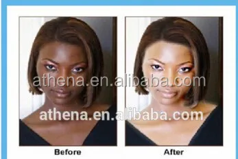 4% гидрохинона 7 Дней Отбеливающий Крем для лица черной