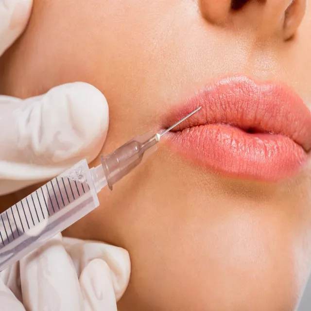 hyaluronic acid filler lips 5ml derm beauty personal care hyaluronic acid filler for lips and cheekbones