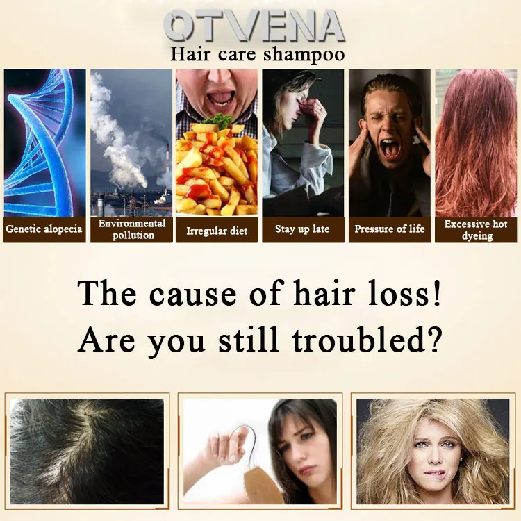 OTVENA hair lost products best private label bottle anti dandruff hair loss shampoo