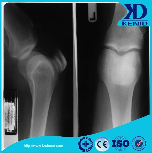 
Hot Medical Blue Film Used in Computed Tomography 