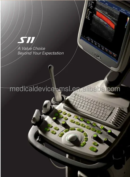 Ультразвуковой цветной допплер-сканер Sonoscape S11 с высоким разрешением echo