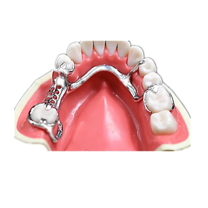
3d printed dental frame 