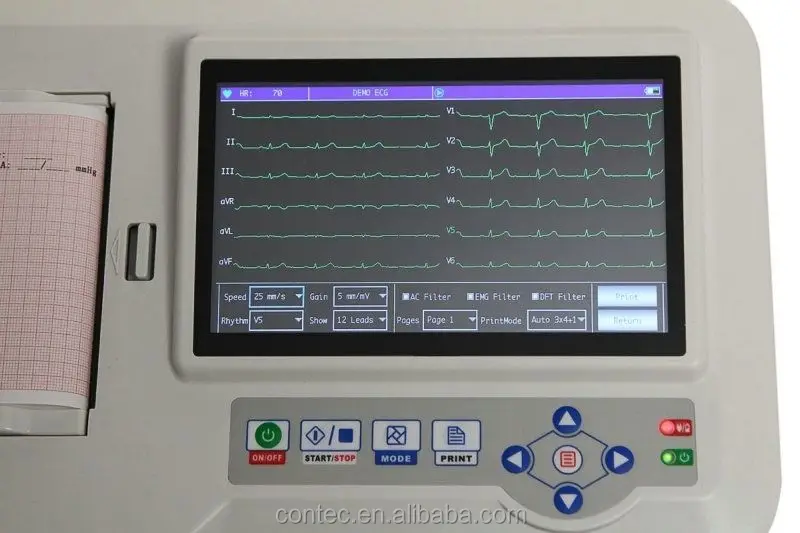 CONTEC ECG600G сенсорный экран 6-ти канальный электрокардиограф ЭКГ + программное обеспечения для подключения к компьютеру