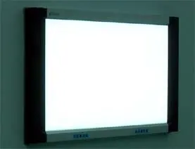 
luxury x ray film viewer 