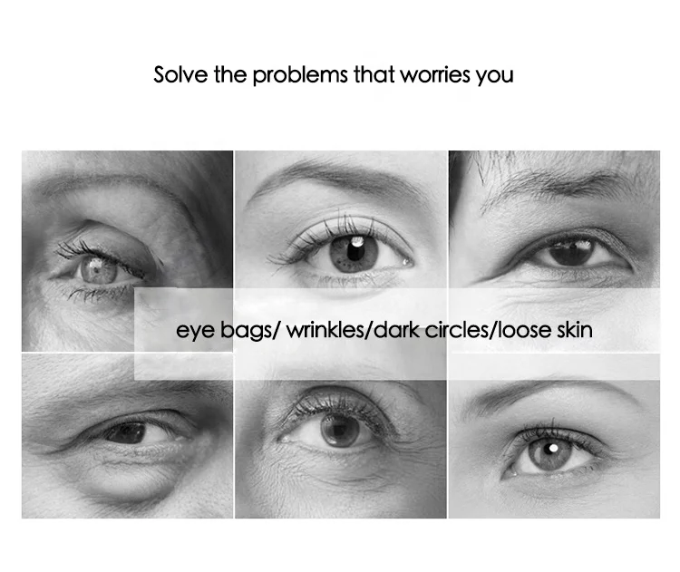 OEM professional skin care instant ageless eye bag removal firming lifting wrinkle filler cream in 2 minutes