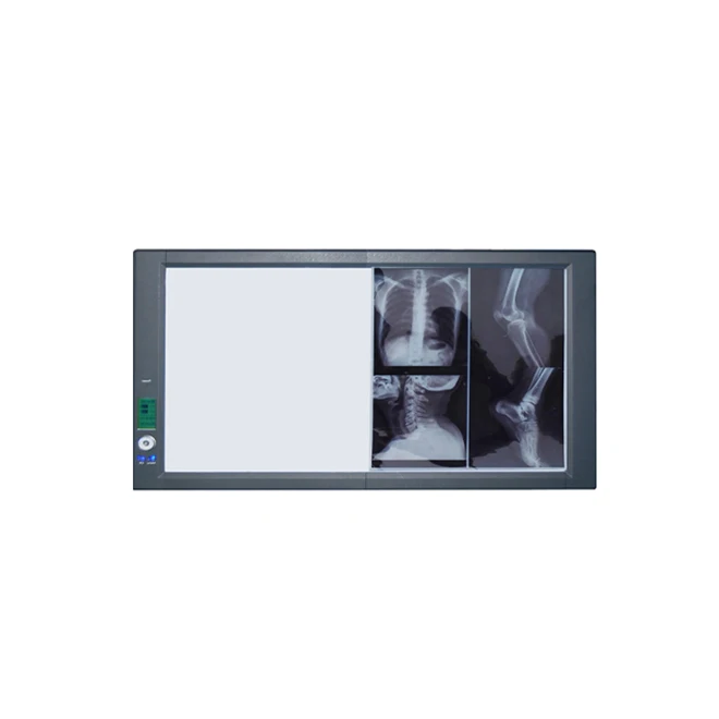 Mplent top sales ZG-2C smart led slim x-ray film viewer negatoscope X Ray illuminator with CE with ISO13485 factory