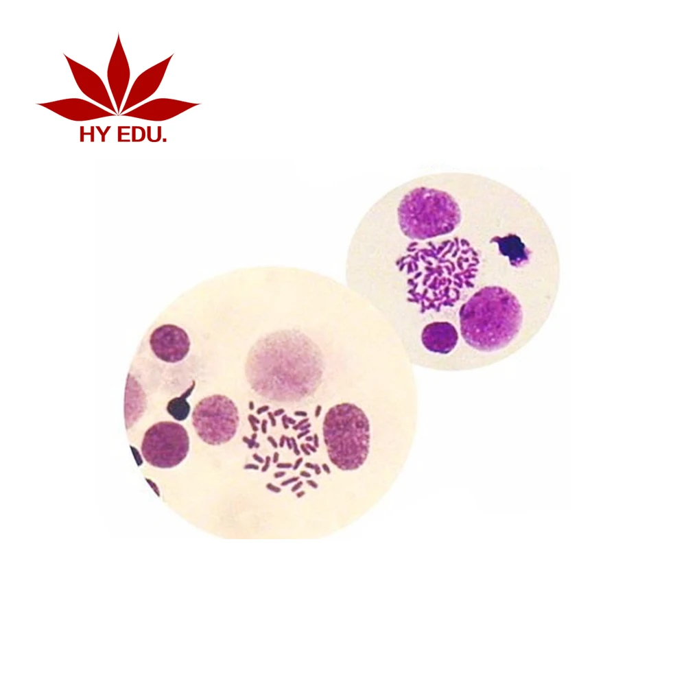 Fixed set high quality 14 pieces chromosome microscope prepared slides,human chromosome slides