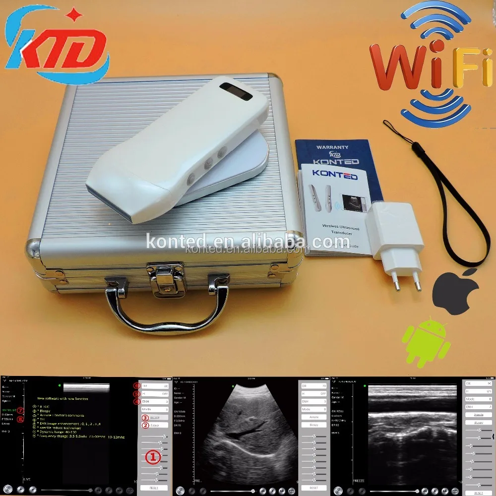 Other Ultrasonic & Electronic Equipment Portable Ultrasound Wireless Linear Probe Scanner 7.5/10mhz