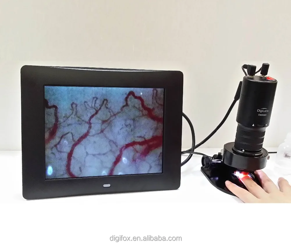 
DMX980-1 биологической микроциркуляционный Микроскоп Цифровой Микроскоп капиллярной Микроскоп 