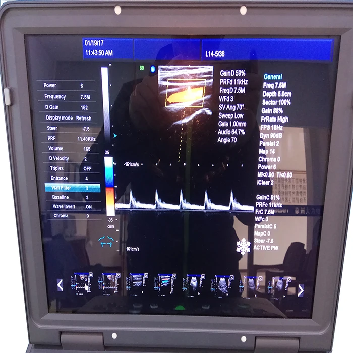 
Medical Portable Doppler Ultrasound Machine 