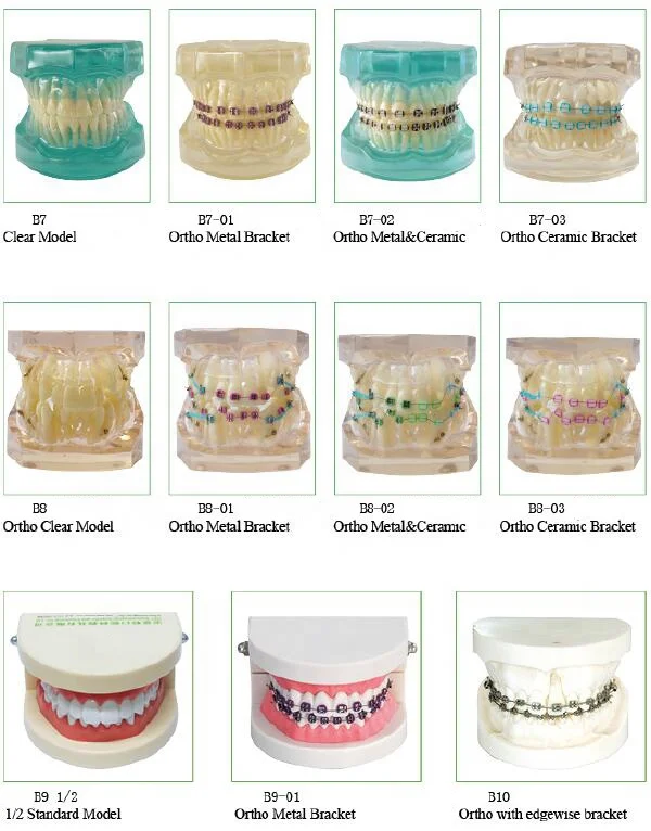 Dental Ortho teeth model