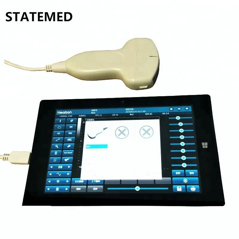  Выпуклый usb-ультразвуковой зонд для сканирования по акционной цене