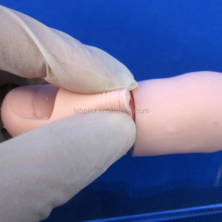 Ingrown Toenail Model,Nail Excision Training Model