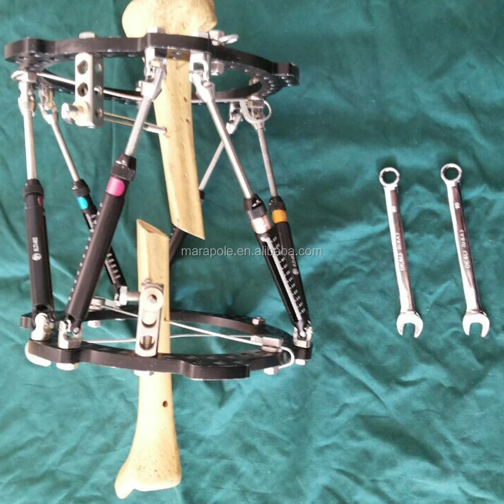 Ilizarov external fixator with foot ring