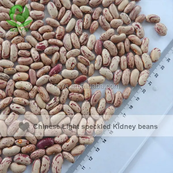 White Beans Type and Kidney Beans Type Light Speckled Kidney Beans