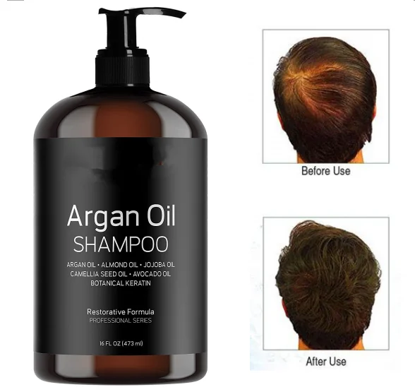 
OEM Private Label Hair Loss Products Sulfate Free Shampoo Bio Natural Argan Oil Keratin Hair Treatment DHT Shampoo and Conditioner 