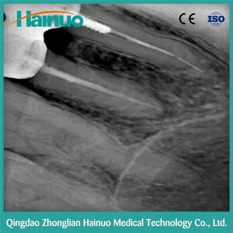 Китай F100 Интраоральной Цифровой X-ray 3D Стоматологических Изображений