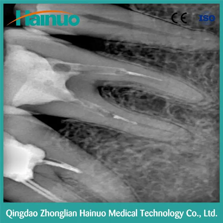 China HDR-500 Intraoral Digital Radiologic Dental X-Ray