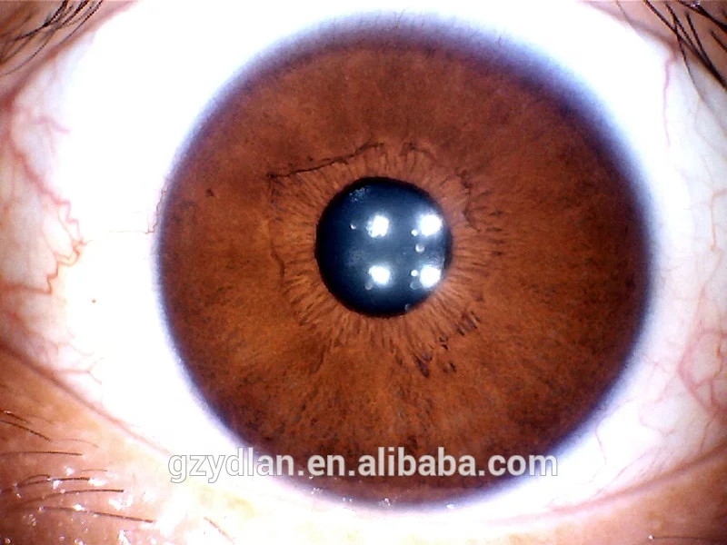 NEW 5.0 MP 4 LED/2 LED USB PRO software iris analyzer machine