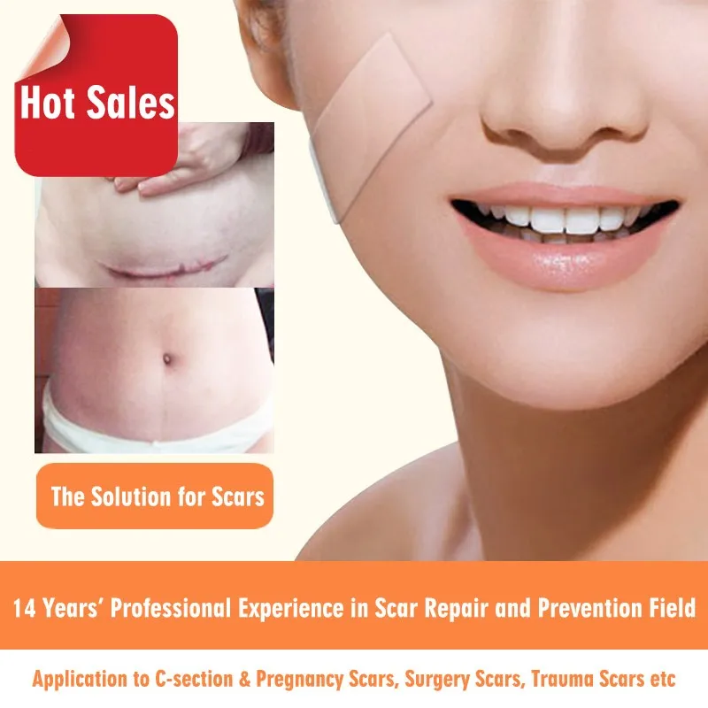 Scar Sheet CE Medical Silicone Waterproof Transparent patch for scars