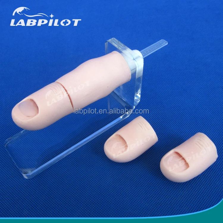 Ingrown Toenail Model,Nail Excision Training Model