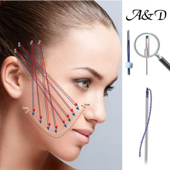 mono pdo thread face liftbest pdo threading for the eye area  beauty products Mono Blunt 30G25mm